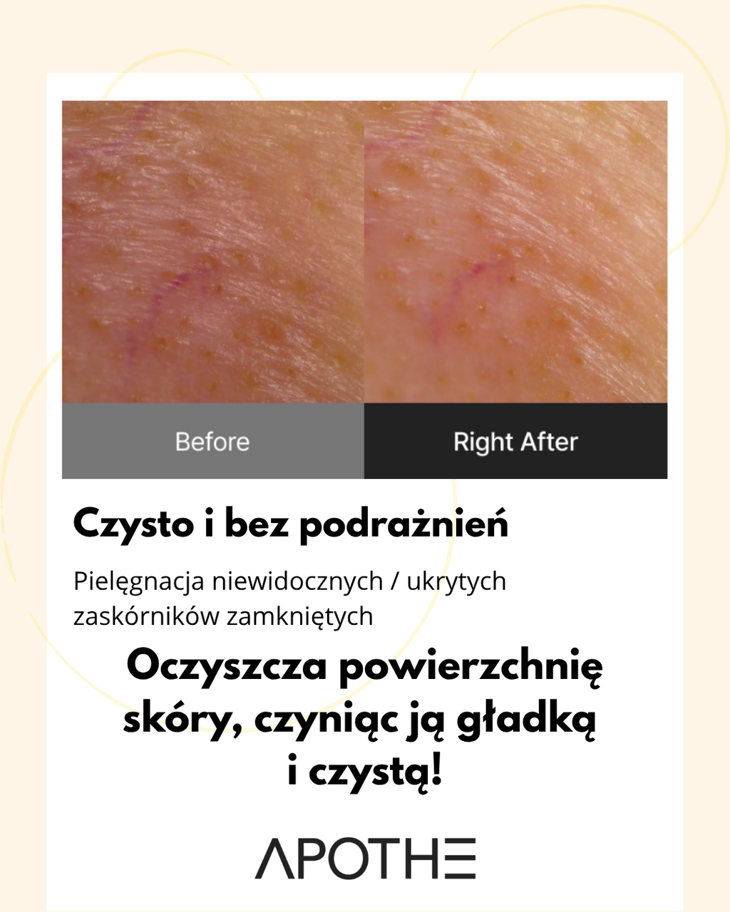 Apothe - Exosome Anti-Pollution Toning Pad - Płatki Tonizujące – 170 ml