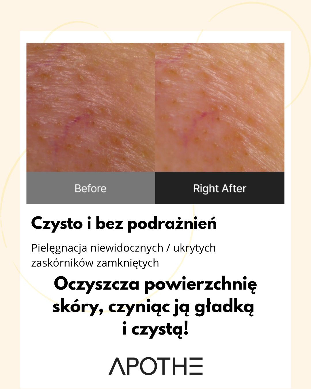 Apothe - Exosome Anti-Pollution Toning Pad - Płatki Tonizujące – 170 ml